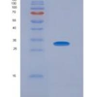 人肝素辅因子Ⅱ(HCII)重组蛋白