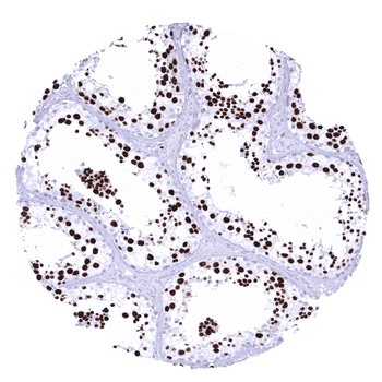 Topoisomerase 2-alpha / TOPO2A