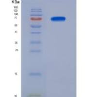 人脯氨酰内肽酶重组蛋白