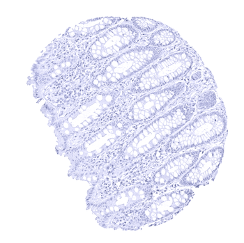 PMEL / gp100 / Melanosome anti