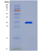 人单核细胞趋化蛋白3(MCP3)重组蛋白