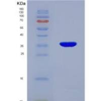 人E1A结合蛋白P300(EP300)重组蛋白