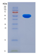 人醛脱氢酶1家族成员B1(ALDH1B1)重组蛋白