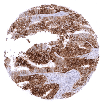 PD-L1 antibody 抗体，orb2276604，B