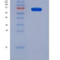 小鼠干扰素调节因子1(IRF1)重组蛋白