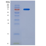 人Mdm2 p53结合蛋白同源物(MDM2)重组蛋白
