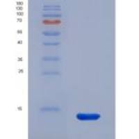 小鼠线粒体解偶联蛋白1(UCP1)重组蛋白