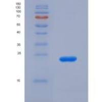 人唾液酸结合Ig样凝集素12(SIGLEC12)重组蛋白