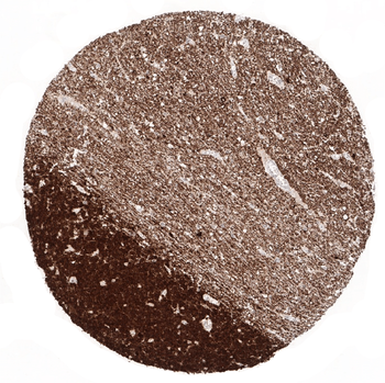 NSE gamma antibody 抗体，orb22765