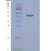 人嗜酸粒细胞趋化因子(ECF)重组蛋白