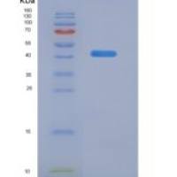 人嗜酸粒细胞趋化因子(ECF)重组蛋白