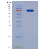 人尿黑酸1,2-双加氧酶(HGD)重组蛋白