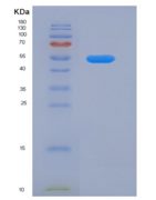 人雌激素受体β(ERb)重组蛋白