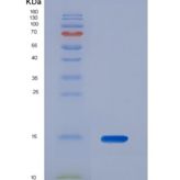 人粘蛋白2(MUC2)重组蛋白