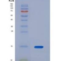 人粘蛋白2(MUC2)重组蛋白