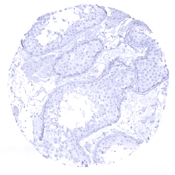 Cytokeratin 7 antibody 抗体，orb2
