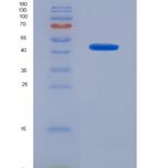 人血红蛋白β(HBb)重组蛋白