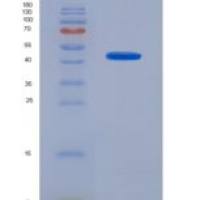 人血红蛋白β(HBb)重组蛋白