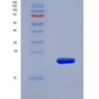 小鼠白细胞衍生趋化因子2(LECT2)重组蛋白