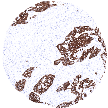 Cytokeratin 13 antibody 抗体，orb