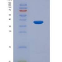 小鼠金属硫蛋白1(MT1)重组蛋白