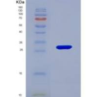 人Kruppel样因子5(KLF5)重组蛋白
