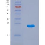 小鼠α白蛋白(AFM)重组蛋白
