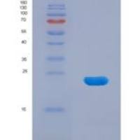 小鼠α白蛋白(AFM)重组蛋白