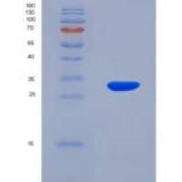 人磷脂酶A2受体1(PLA2R1)重组蛋白