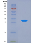 人孕酮免疫调节结合因子1(PIBF1)重组蛋白