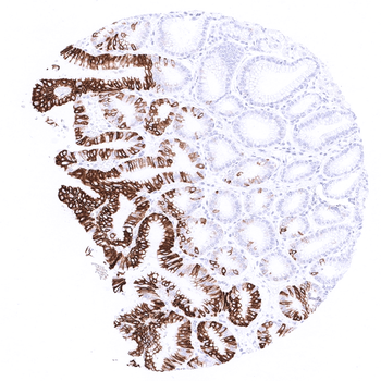Cytokeratin 20 antibody 抗体，orb