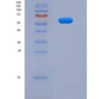 小鼠Pyruvate kinase isozymes M2 (PKM2)重组蛋白
