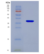 人类固醇5α还原酶2(SRD5a2)重组蛋白