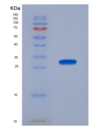 小鼠神经元正五聚蛋白Ⅱ(NPTX2)重组蛋白