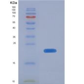 人EGF样域蛋白6(EGFL6)重组蛋白
