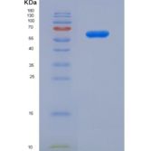 人ANXA5-RFP重组蛋白