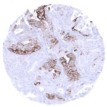 Cytokeratin 6 antibody 抗体，orb2