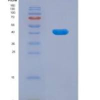 人D2组范可尼贫血偶联因子(FANCD2)重组蛋白