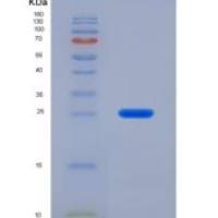大鼠沉默调节蛋白4(SIRT4)重组蛋白