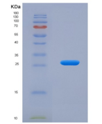 小鼠类粘蛋白2(ORM2)重组蛋白