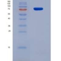 人90kDa热休克蛋白αB1(HSP90aB1)重组蛋白