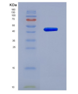小鼠核糖核酸酶A(RNase A)重组蛋白