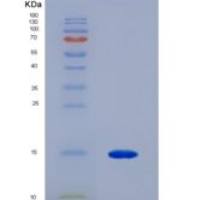 小鼠泛素关联蛋白2(UBAP2)重组蛋白