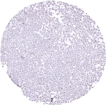 E-Cadherin Antibody 抗体，orb2276