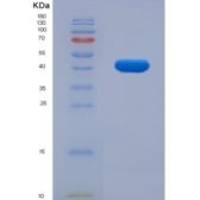 小鼠多巴胺受体D1(DRD1)重组蛋白