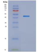 人脂蛋白关联磷脂酶A2(LpPLA2)重组蛋白