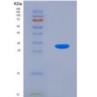 小鼠硫氧还蛋白还原酶1(TXNRD1)重组蛋白