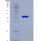 人几丁质酶3样蛋白2(CHI3L2)重组蛋白