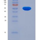 人醛脱氢酶1家族成员B1(ALDH1B1)重组蛋白