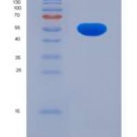 人醛脱氢酶1家族成员B1(ALDH1B1)重组蛋白